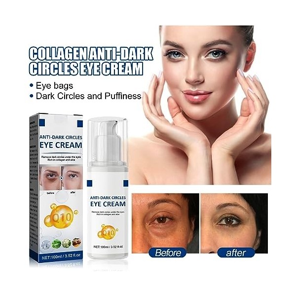 Contre Les Cernes,Crème pour Yeux au Jasmin,Crème Contour des Yeux Cernes et Poches,Crème Contour des Yeux,Creme Anti Rides Y