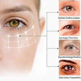 2 pcs Crème de Soin Des Yeux Vitamine C Crème Pour Les Yeux Anti-rides Élimination Des Cercles Noirs Crème Hydratante Pour Le