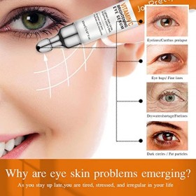 Cynamus Crème pour Les Yeux,Crème pour Les Cernes,Sérum des Yeux à la Vitamine C,Crème Anti-Rides pour Les Yeux, Infusé de Vi