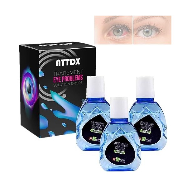 Attdx Eye Drops, Attdx Treatment Eyeproblems Solutiondrops, Eye Drops For Dry Itchy Eyes, Attdx Eyedrops Repair, Eye Care Liq