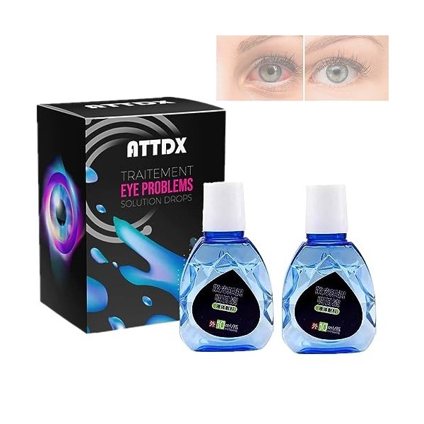 Attdx Eye Drops, Attdx Treatment Eyeproblems Solutiondrops, Eye Drops For Dry Itchy Eyes, Attdx Eyedrops Repair, Eye Care Liq