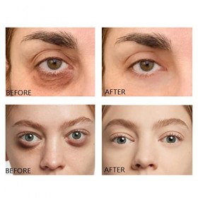 Sérum Réparateur pour les Yeux, Sérum pour les Yeux Atténués par les Cernes, Élimination des Poches pour les Yeux, Sérum Anti