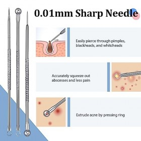 Lot de 6 outils de retrait de comédons et de comédons pour enlever les points noirs et les points noirs avec étui