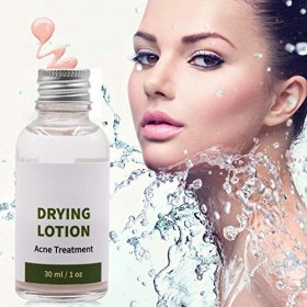 Traitement dacné Lotion asséchante - Anti Acné Serum Pimple Blimish Removal - Traitement de lacné Sérum pour la peau claire