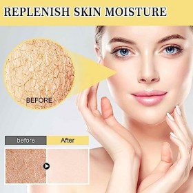 Escargot Mucine Essence, 96,3 Snail Mucin Power Essence Hydratant À Lessence Dacide Hyaluronique Hydrating Essence Snail Mu