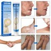 2Pcs Vitiligo Cream, Crème de Traitement du Vitiligo, Vitiligo Pommade Leukoplakia, Traitement des Taches Blanches sur la Pea