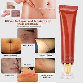 Crème de réparation délimination des cicatrices, pommade éclaircissante contre les imperfections, modifier correcteur hydrat