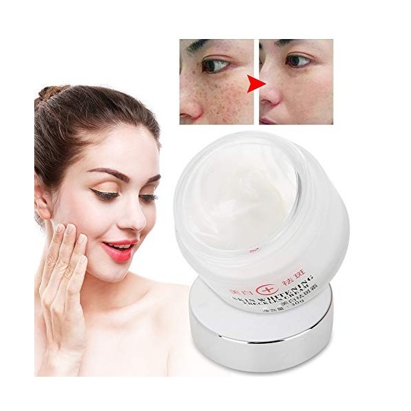 Crème blanchissante, crème faciale anti-mélasma pour éliminer les taches de rousseur, rajeunissement de la peau du visage, nu