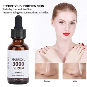 Sérum Blanchissant Pour La Peau, Sérum Dissolvant Pour Sérum Visage Blanchissant 30 ml DAcide Hyaluronique Pour Sérums Et Fl