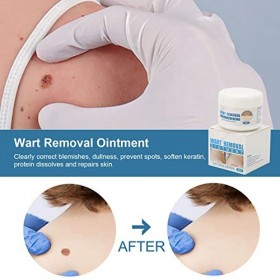 Crème Délimination des Taches à Grande Capacité, Lotion Délimination des Taches Naturelles pour Homme et Femme, Soins de la