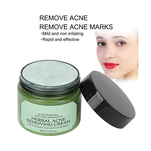 Crème Dacné pour le Visage, Crème Hydratante, Hydratant pour le Visage, Extraits Darbre à Thé, Huile de Contrôle des Marque