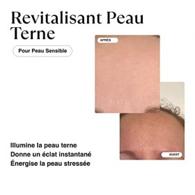MATKAS Sérum Coréen Niacinamide Pour Le Visage - Pour Excès de Sébum, Pores Dilatés, Teint Irrégulier, Teint Terne - Centella