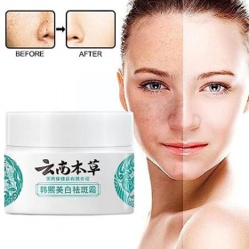 3 pièces de crème mélasma japonaise, Crème Hoshi Japon, Crème anti-taches blanches Dr Hancy, Correcteur de taches brunes pour