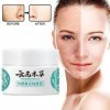 3 pièces de crème mélasma japonaise, Crème Hoshi Japon, Crème anti-taches blanches Dr Hancy, Correcteur de taches brunes pour