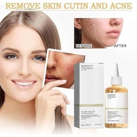 Advanced Snail 96 Mucin Power Essence 2 