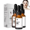 Fast Freckles Remover Serum Nature Dark Spot Remov, 15ml Freckle Remover Serum, Dark Spot Remover For Face, Anti Dark Spot An