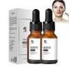 Fast Freckles Remover Serum Nature Dark Spot Remov, 15ml Freckle Remover Serum, Dark Spot Remover For Face, Anti Dark Spot An