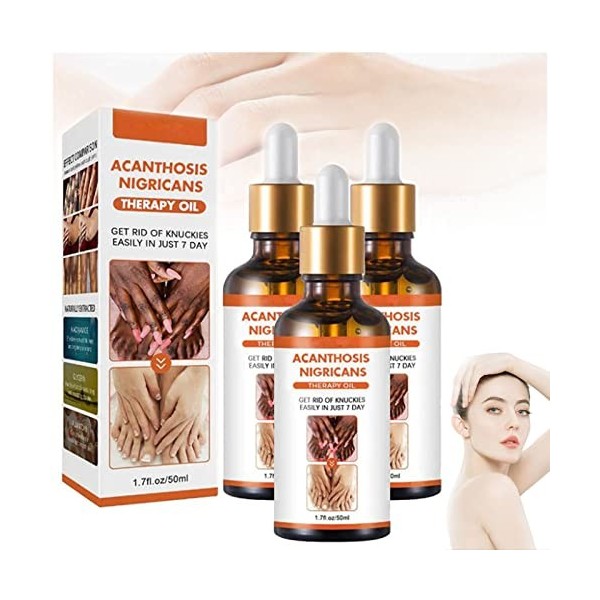 Acanthosis Nigricans Therapy Oil, Dark Knuckle Whitening Serum, Acanthosis Nigricans Relief Oil, Dark Spots Cream Body Whiten