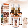 Acanthosis Nigricans Therapy Oil, Dark Knuckle Whitening Serum, Acanthosis Nigricans Relief Oil, Dark Spots Cream Body Whiten