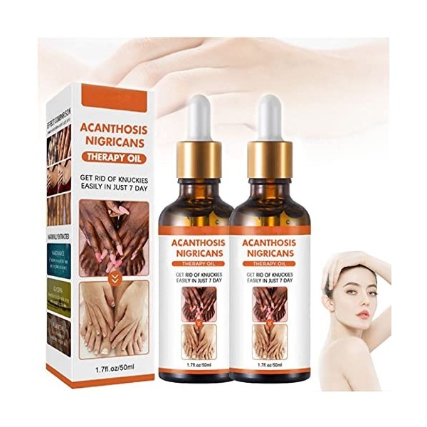 Acanthosis Nigricans Therapy Oil, Dark Knuckle Whitening Serum, Acanthosis Nigricans Relief Oil, Dark Spots Cream Body Whiten