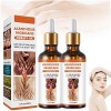 Acanthosis Nigricans Therapy Oil, Dark Knuckle Whitening Serum, Acanthosis Nigricans Relief Oil, Dark Spots Cream Body Whiten