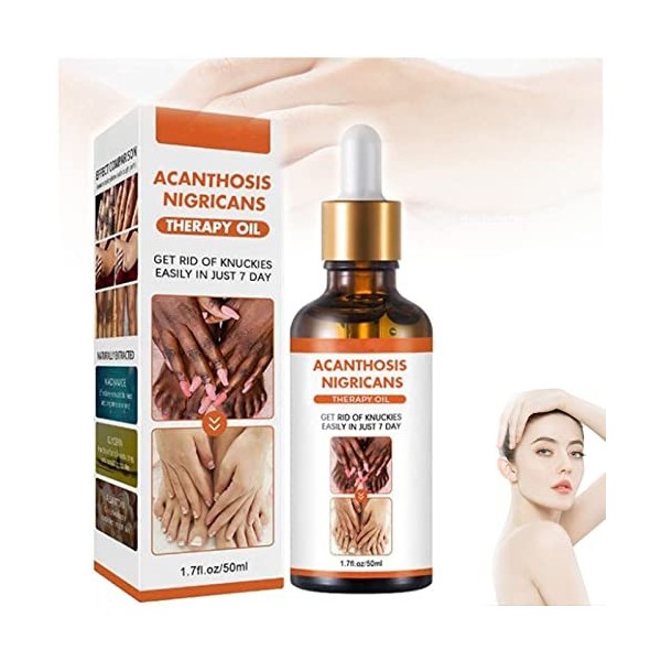 Acanthosis Nigricans Therapy Oil, Dark Knuckle Whitening Serum, Acanthosis Nigricans Relief Oil, Dark Spots Cream Body Whiten