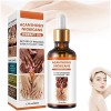 Acanthosis Nigricans Therapy Oil, Dark Knuckle Whitening Serum, Acanthosis Nigricans Relief Oil, Dark Spots Cream Body Whiten