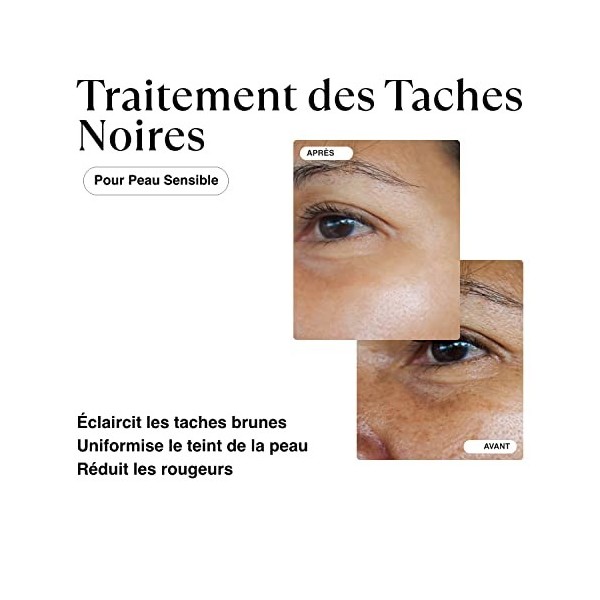 MATKAS Sérum Coréen Anti Taches Visage Correcteur + Niacinamide + Extrait dAvoine pour Corriger en Profondeur le Teint Irrég