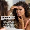 IVACHI Sérum pour le visage Galactomyces - Sérum hydratant et anti-âge avec ferment Filtrate de Galactomyces, niacinamide, gl