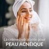 Crème Lait De Chèvre Visage | Traitement Efficace Contre lAcné | Crème Hydratante Peau Acnéique | Crème de jour peau à imper