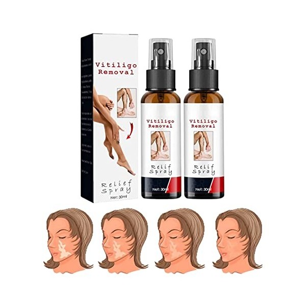 Gienslru Vitiligo Removal Relief Spray, Vitiligoremoval Relief Spray, Vitiligo Skin Repair Spray, Vitiligo Treatment Spray, R