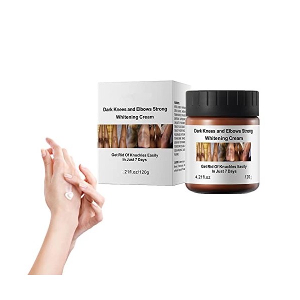 GFOUK AcanthoGlow Therapy Cream, 120g Dark Knees and Elbows Strong Whitening Cream 2PCS