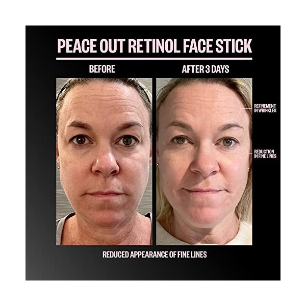 PEACE OUT Bâton visage au rétinol pour réduire les ridules, les rides et la texture inégale avec 3 % de rétinol encapsulé 0,