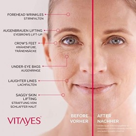 Vitayes Instant Ageback 15ml , Creme Anti-Rides, Agit en 5 Minutes! Moins de Rides, Moins de Cernes, une simple application,