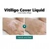 Vitiligo Cover Liquid, Vitiligo Covering Liquid Waterproof Makeup Vitiligo Concealer Cosmetics For Face Body 20ml