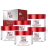 Brightening Freckle Cream,Heykomi Whitening Freckle Cream 5PCS/250g 