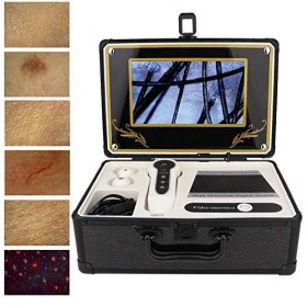 Diagnostic de la Peau Analyseur de Cheveux, 50x 200x Digital Dettecteur de Peau Humidité Testeur Analyseur de Peau Follicule 