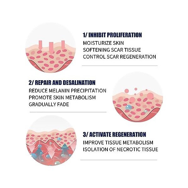 Crème Délimination des Cicatrices, Crème Délimination des Cicatrices Réparatrice Adoucissante, Crème Délimination des Verg