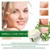La crème fermée améliore la sécurité de la réparation de la Bouche Nouvelle Peau acné Hydrate Les Soins de la Peau personnels