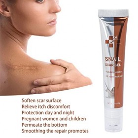 Crème Anti-cicatrices, Crème Anti-cicatrices pour les Vieilles Cicatrices, Crème Anti-cicatrices pour la Nouvelle Croissance 