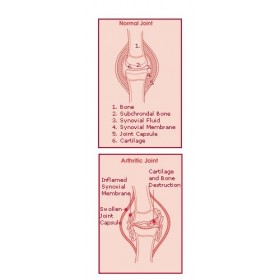 Tablettes de JointEase - 1050