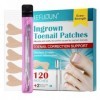 Bandes correctrices d’ongles | Lisseur dongles 120 pièces | Patchs de correction des ongles pour soulager les ongles incarné