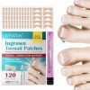 Patch de correction des ongles des pieds, Lisseur dongles 120 pièces, Réparation des ongles des orteils pour les ongles cour