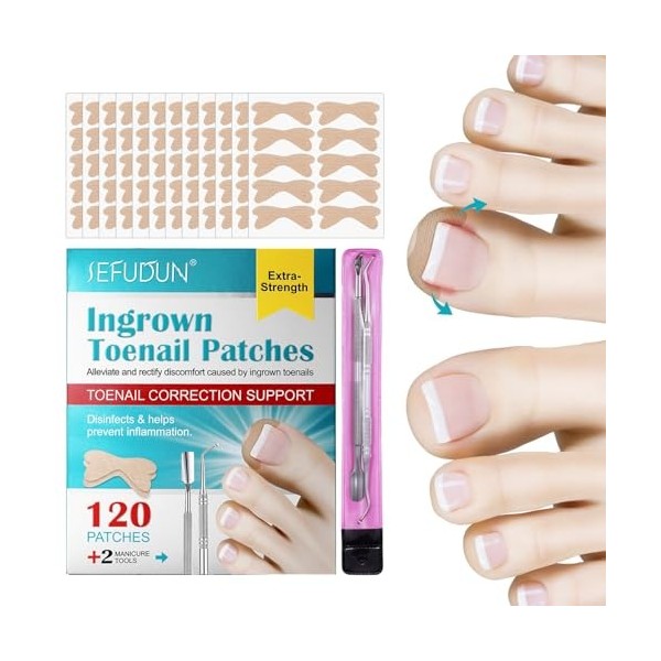 Patch de correction des ongles des pieds | Lisseur dongles 120 pièces | Patchs de correction des ongles pour soulager les on