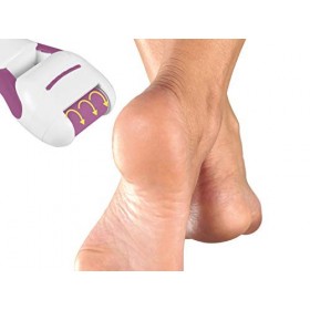 Beper 40.939&nbsp;–&nbsp;Lime à callosités