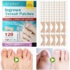 Patch pour ongles incarnés | Lisseur dongles 120 pièces | Réparation des ongles des orteils pour les ongles courbés ou redre