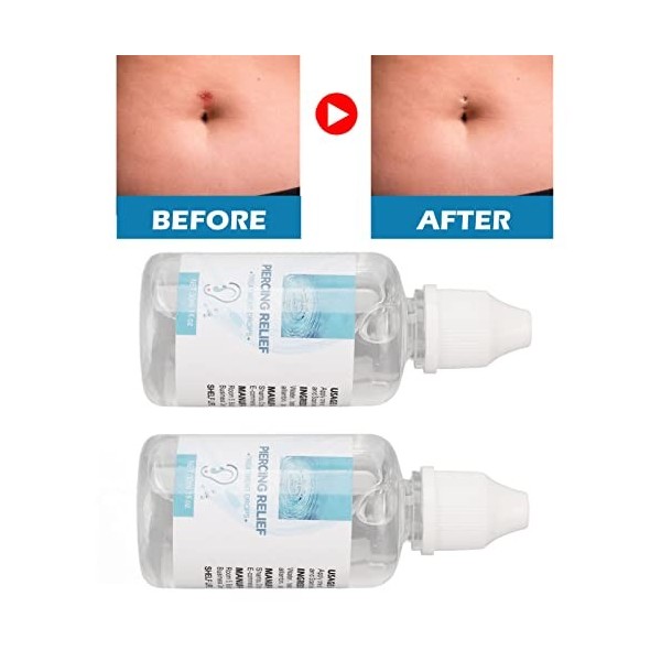 Piercing Bump Removal Drops, Piercing Aftercare Keloid Drops Favorise la Guérison Prévient les Inflammations pour un Usage Qu