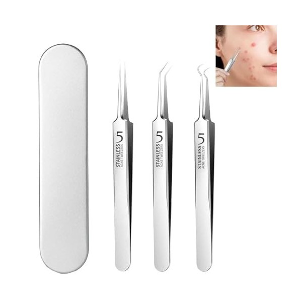 Teppeic - Teppeic Tweezers,Teppeic Tweezers For Blackheads,Teppeic Tweezers For Acne,3 In 1 Professional Stainless Removing T