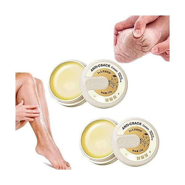 TTCPUYSA Crème réparatrice pour la Peau craquelée Hiver 2022, Gel Anti-Fissuration Hivernal, crème nourrissante pour Les Pied