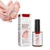 GFOUK - Dissolvant de maïs pour pieds - Gel extra fort - Liquide extra fort